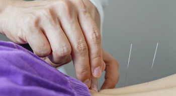 Brasil regulamenta exercício profissional da acupuntura