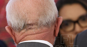 Lula recebe liberação médica para viajar de avião