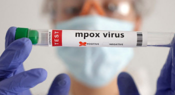 Secretaria de Saúde confirma segundo caso de mpox do grupo lp em SP